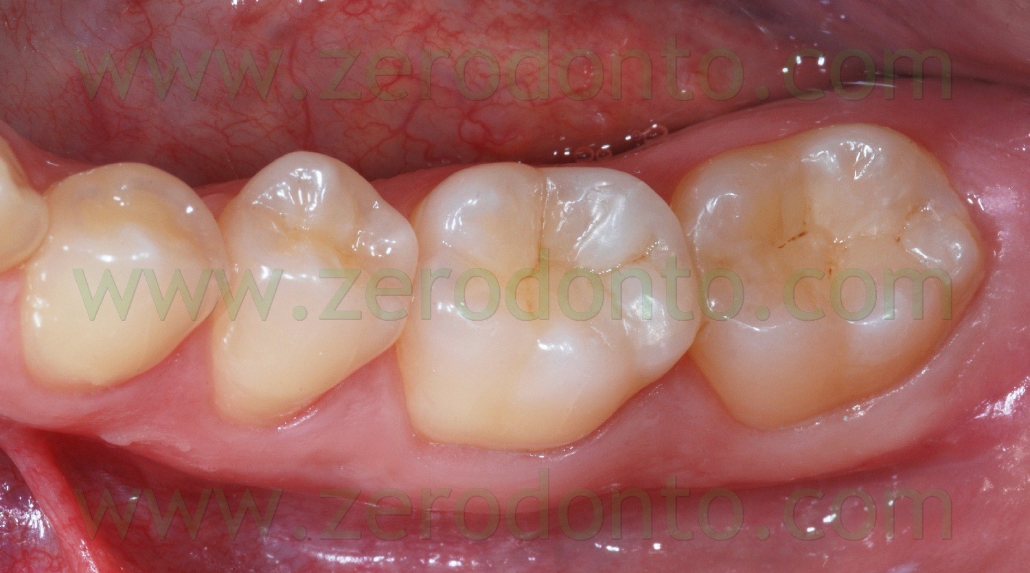 [Fig0093Rosti Q3[2].jpg]