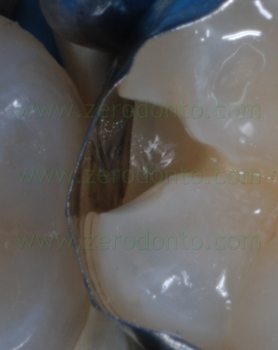 [Fig0074Rosti Q4[4].jpg]