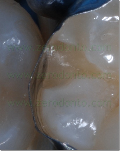 Fig0076Rosti Q4