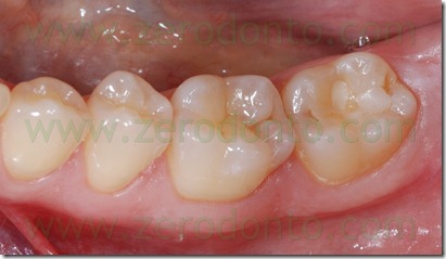 Fig0082Rosti Q3