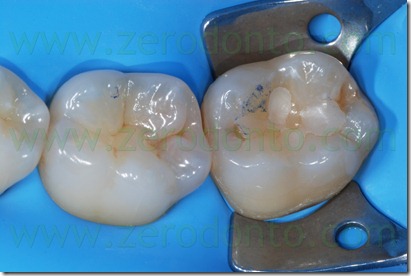 Fig0083Rosti Q3