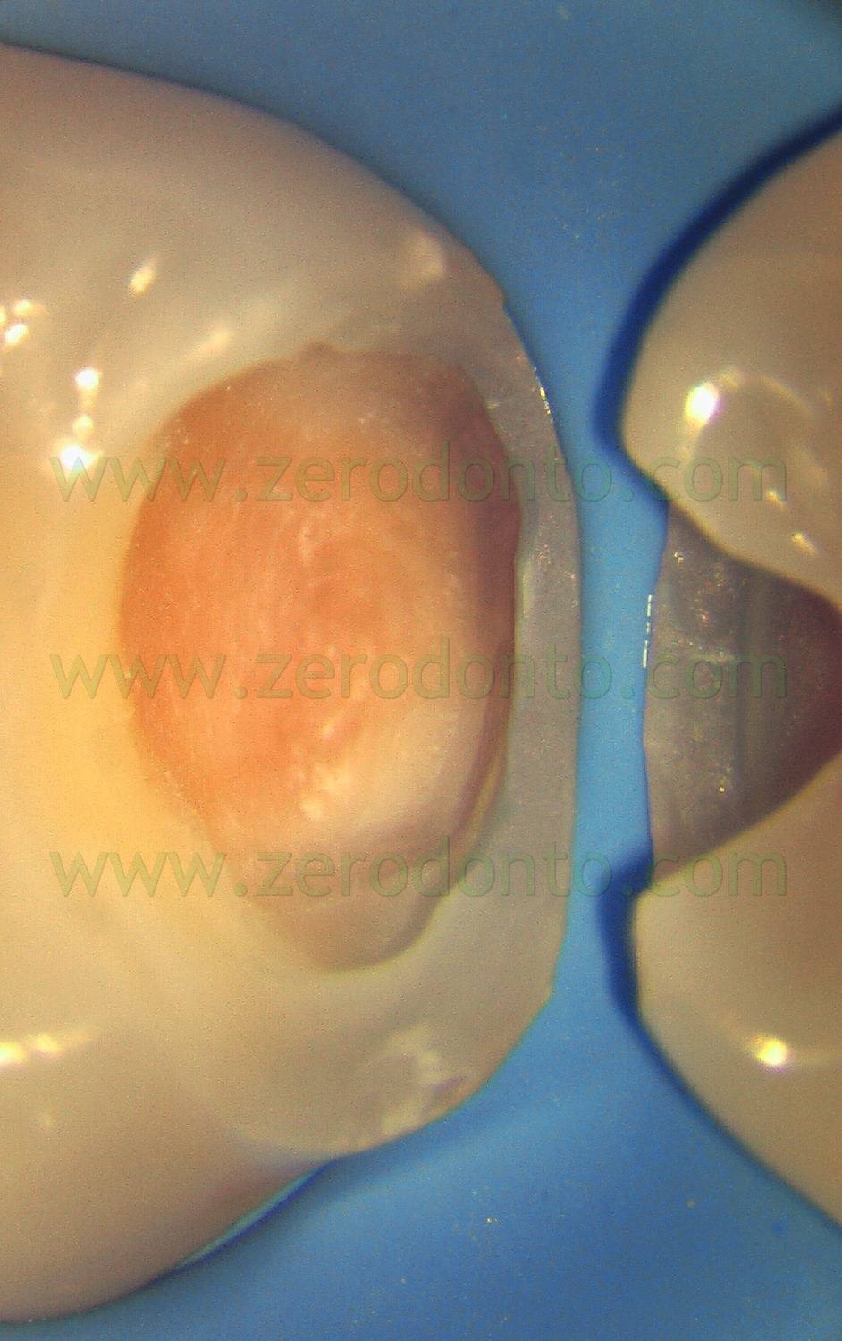 [Fig0085Rosti Q3[3].jpg]