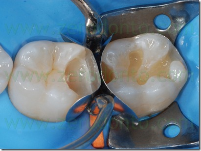 Fig0087Rosti Q3