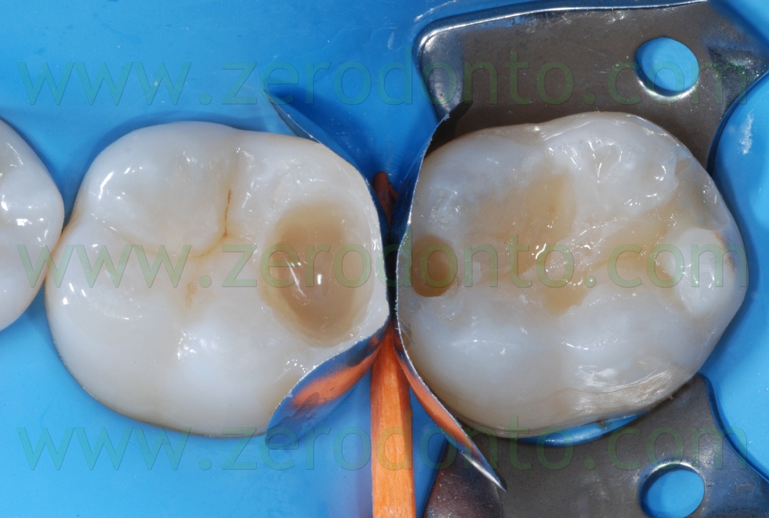 [Fig0089Rosti Q3[2].jpg]
