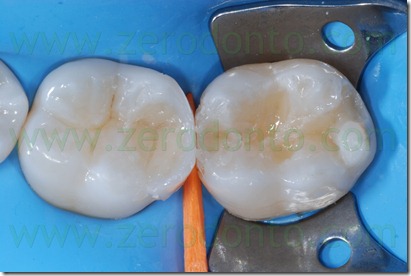 Fig0090Rosti Q3