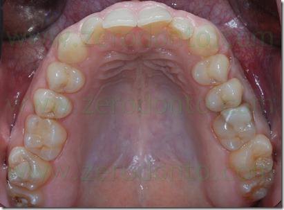 Fig0007Rosti Q1