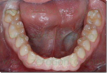 Fig0006Rosti Q1