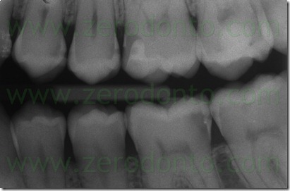 Fig0002Rosti Q1