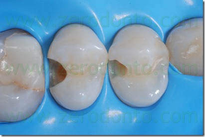 Fig0010Rosti Q1