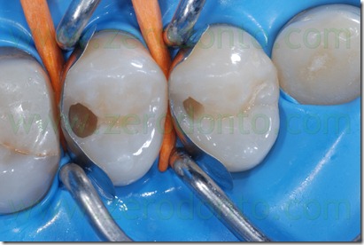 Fig0012Rosti Q1