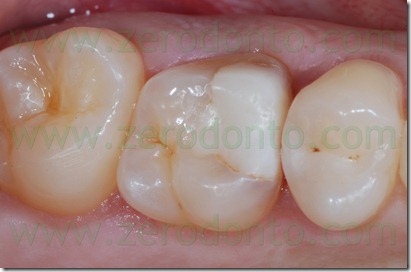 Fig0015Rosti Q1