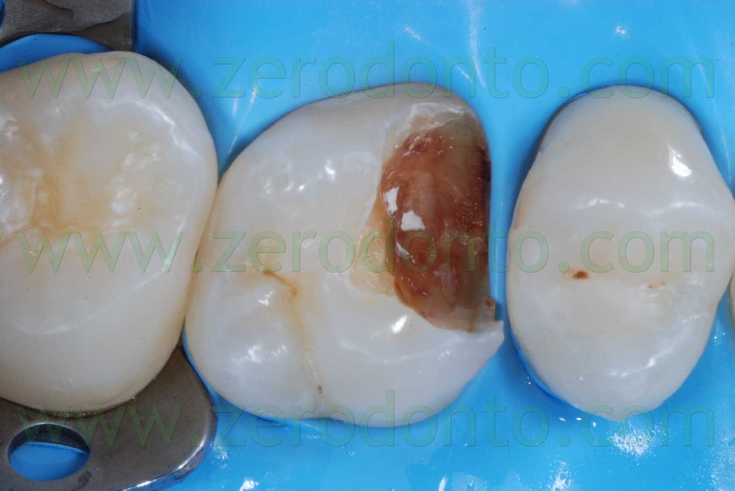 [Fig0018Rosti Q1[2].jpg]