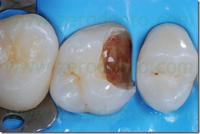 Fig0018Rosti Q1