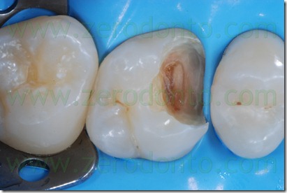 Fig0019Rosti Q1