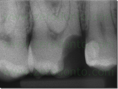 Fig0020Rosti Q1