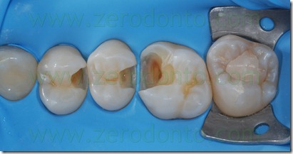 Fig0045Rosti Q2