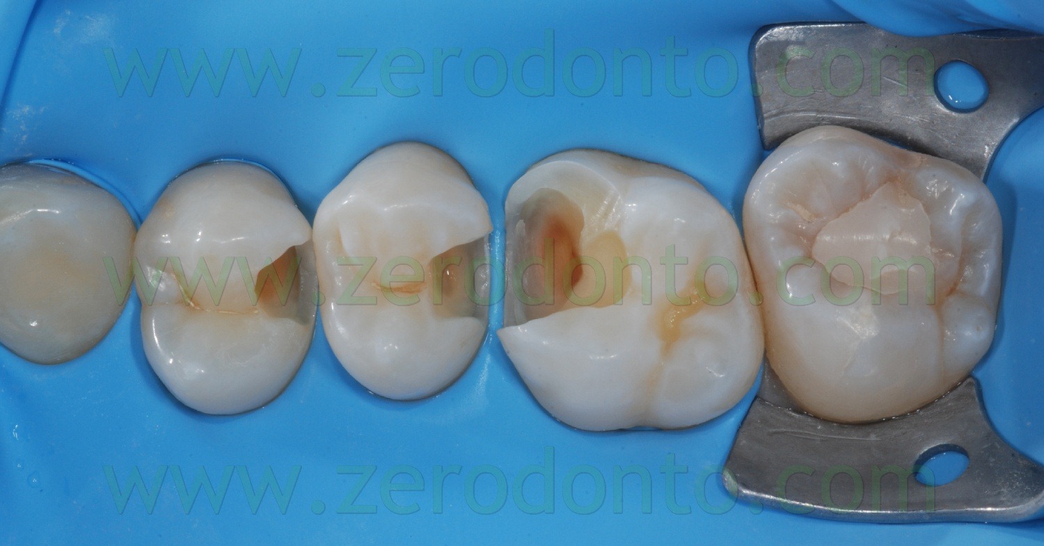 [Fig0045Rosti Q2[2].jpg]