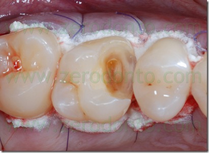 Fig0027Rosti Q1