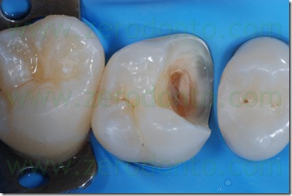 Fig0028Rosti Q1