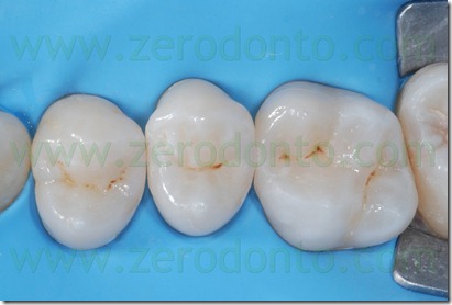 Fig0048Rosti Q2