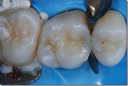 Fig0038Rosti Q1