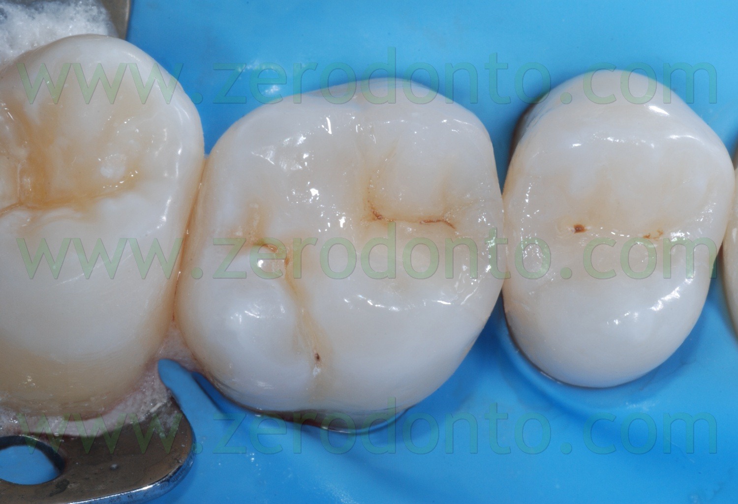 [Fig0041Rosti Q1[2].jpg]