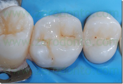 Fig0041Rosti Q1