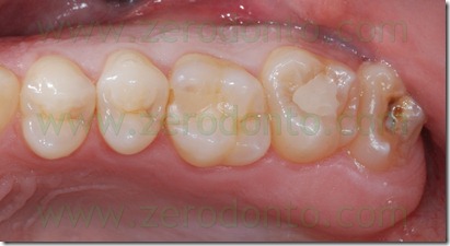 Fig0044Rosti Q2