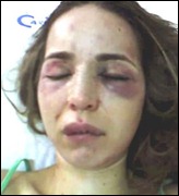 violencia domestica
