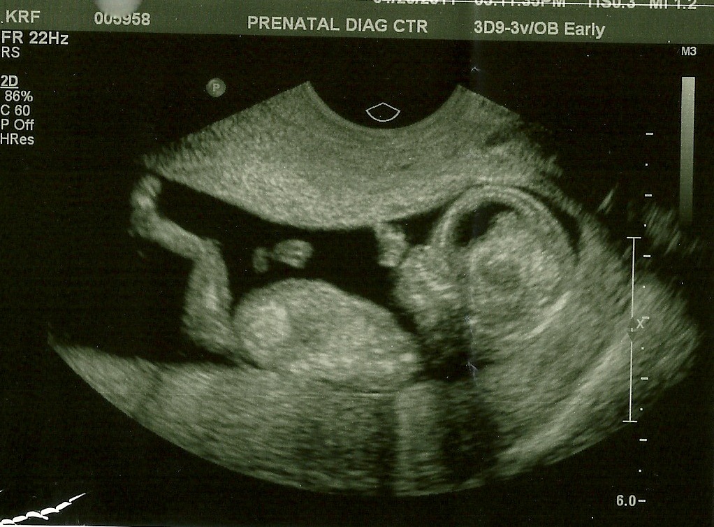 [Scan_Pic0002.jpg]