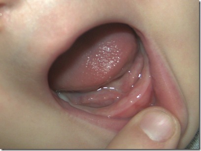 PICT4010