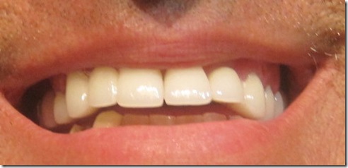 teeth 019