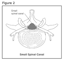 [ssfig2[7].png]