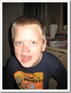 March 09 113