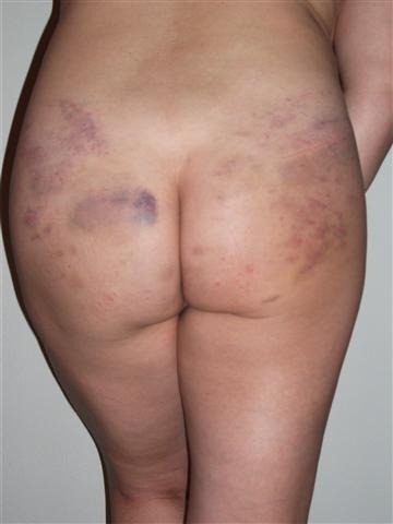 [Blauwebillen[2].jpg]