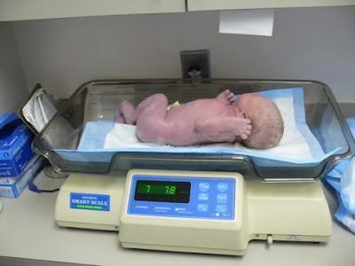 Birth