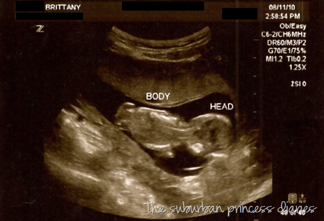 [blogsafeultrasound223.png]