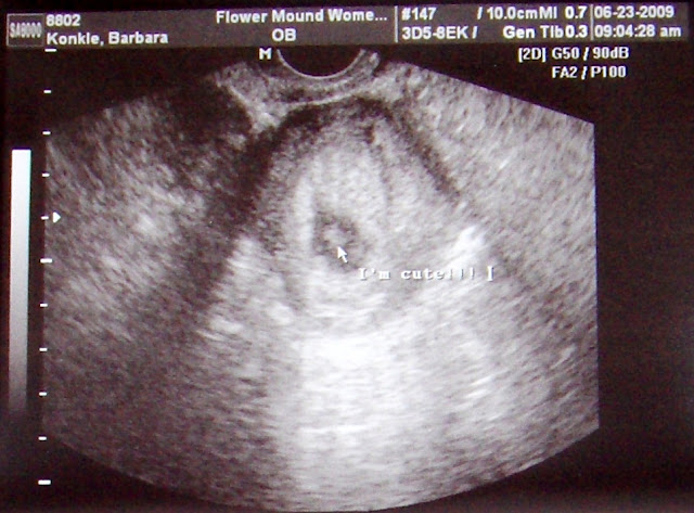 Baby Is Cute.jpg