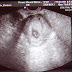 Baby Is Cute.jpg