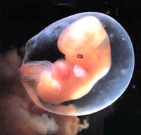 ECTOPIC PREGNANCY ECTOPIC PREGNANCY
