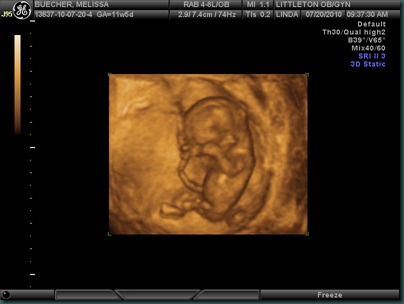 BABY 12 WEEKS_3