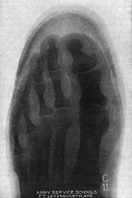 [Munson-X-Ray3.jpg]