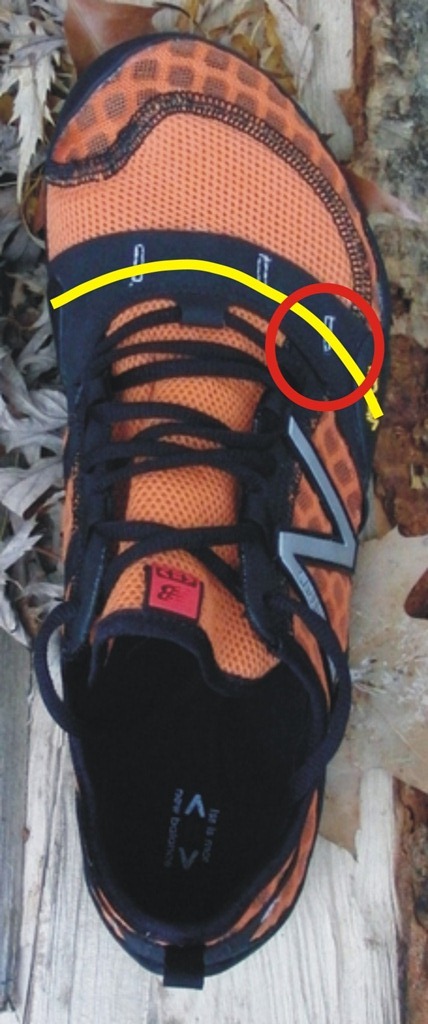 [New Balance Minimus Trail Metatarsal Band[4].jpg]