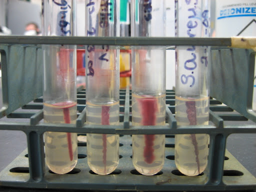 staphylococcus aureus gram stain. stain usinga gram aureus