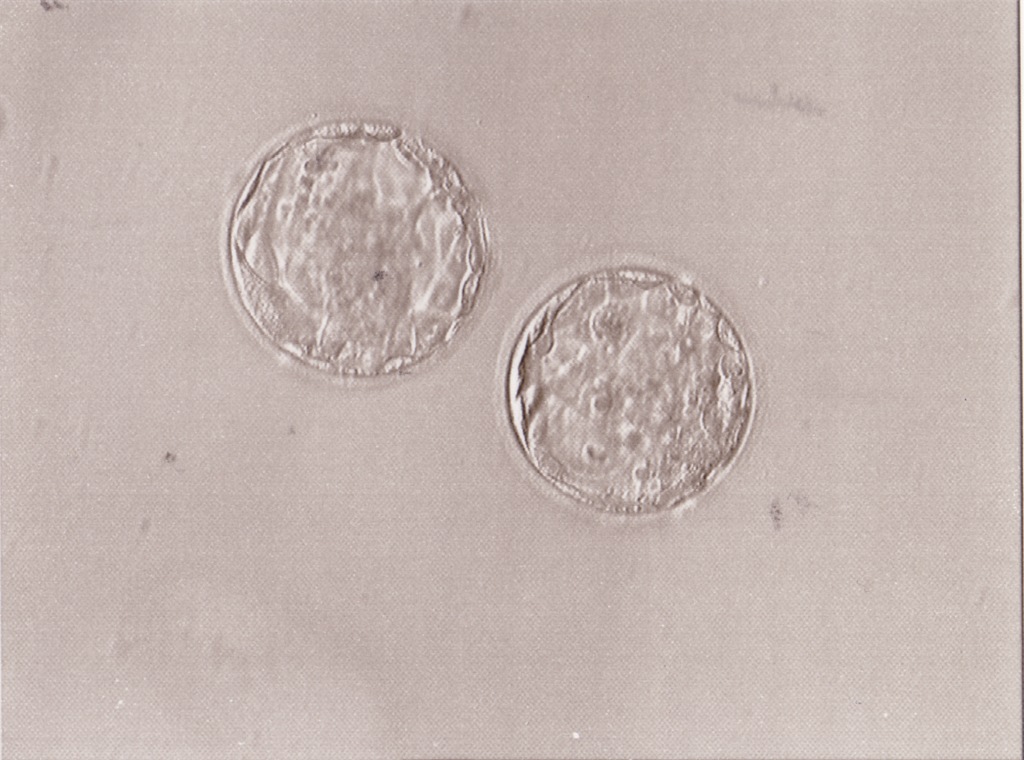 [Embryos[5].jpg]
