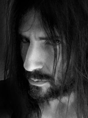 Bumblefoot_-_20100807_-_100_1517c.jpg