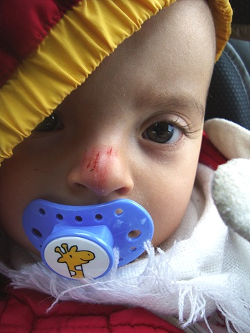 [Nora med skadad näsa[13].jpg]