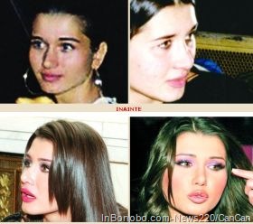 [elena_basescu_cosmeticSurgery[17].jpg]