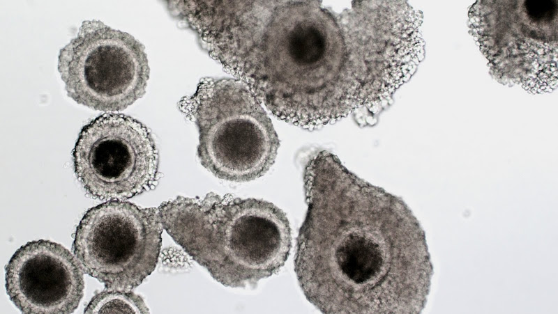 Immature Oocytes
