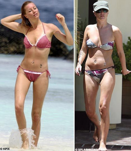 Imperfeições das Celebridades